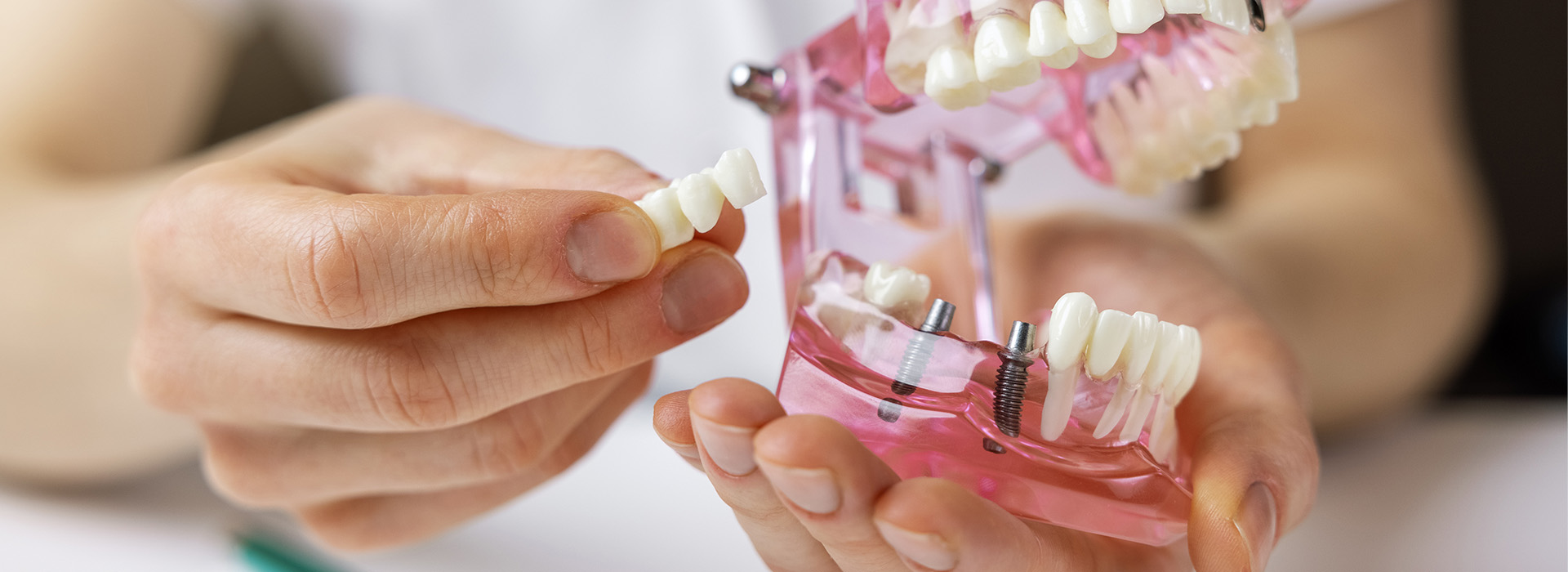 Rosenstein   Gartner Dentistry, PLLC | Sleep Apnea, Digital Impressions and Dental Cleanings