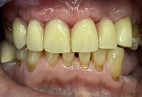 Rosenstein   Gartner Dentistry, PLLC | Guided Biofilm Therapy, Dental Cleanings and Voice Works