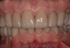 Rosenstein   Gartner Dentistry, PLLC | Sleep Apnea, Dental Cleanings   Hygiene and Oral Exams