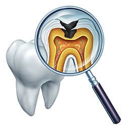 Rosenstein   Gartner Dentistry, PLLC | Digital Radiography, Dental Fillings and Teeth Whitening