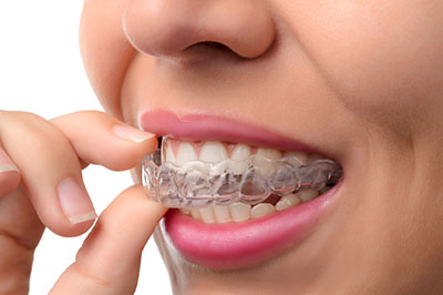 Rosenstein   Gartner Dentistry, PLLC | Guided Biofilm Therapy, Preventative Program and Invisalign reg 