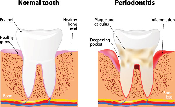 Rosenstein   Gartner Dentistry, PLLC | Sleep Apnea, Root Canals and Veneers