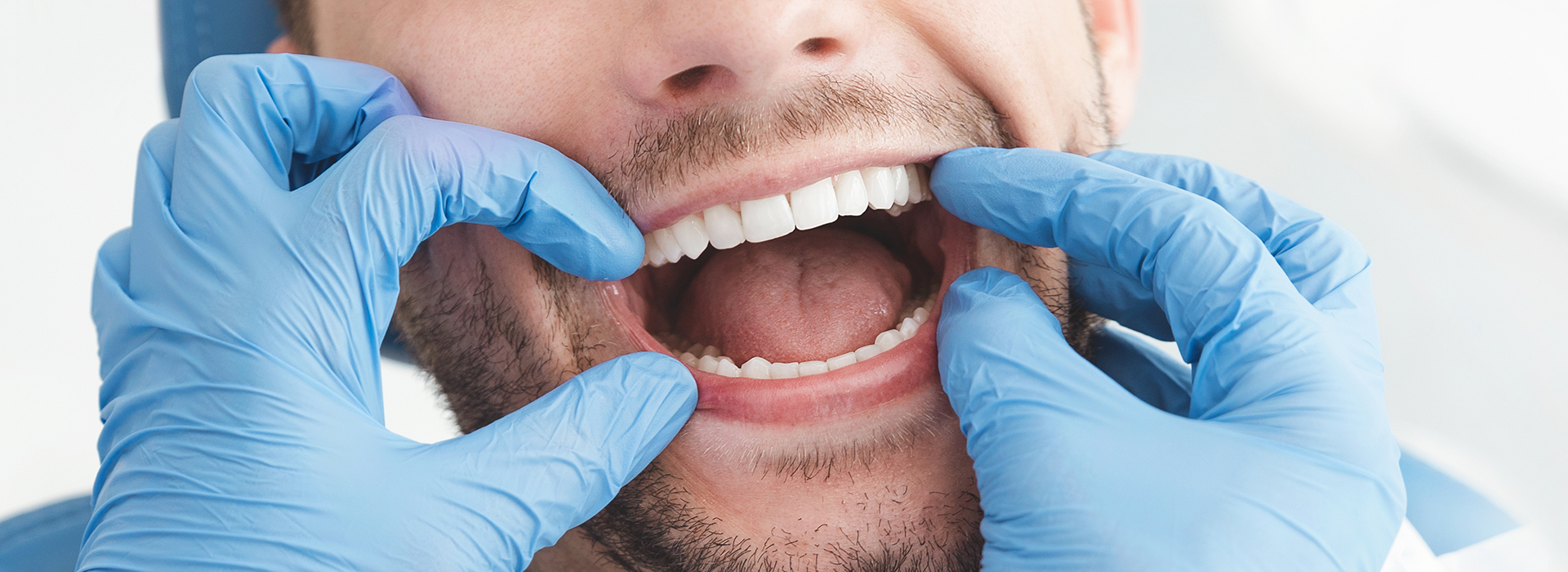 Rosenstein   Gartner Dentistry, PLLC | Crowns  amp  Onlays, Voice Works and Dental Implants   Restorations