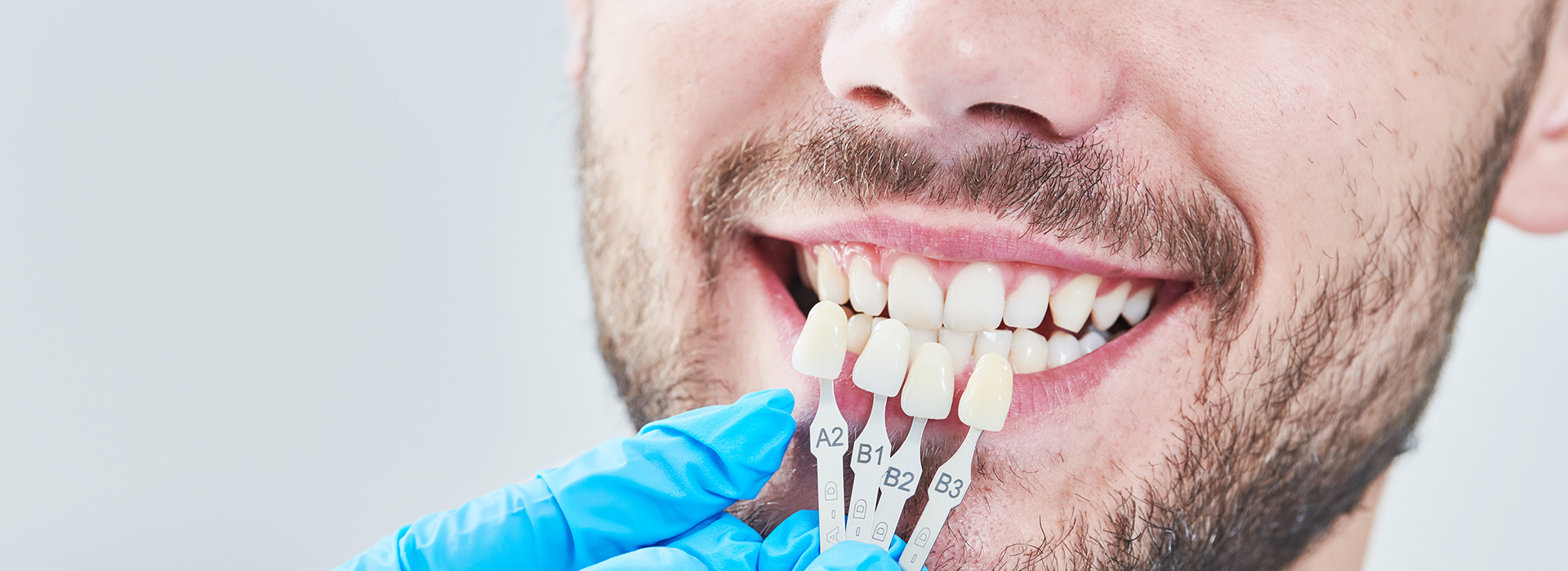 Rosenstein   Gartner Dentistry, PLLC | Preventative Program, Dental Fillings and Crowns  amp  Onlays